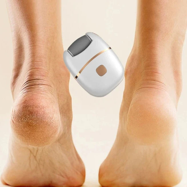 USB Rechargeable Electric Foot Callus Remover™